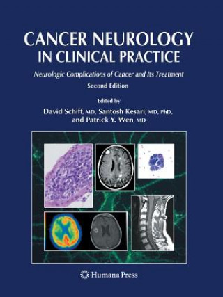 Книга Cancer Neurology in Clinical Practice David Schiff