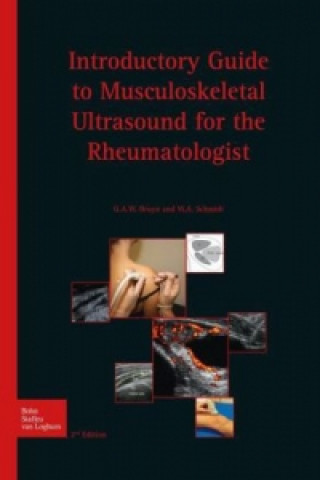 Carte Introductory guide to musculoskeletal ultrasound for the rheumatologist - ROW G. A. W. Bruyn