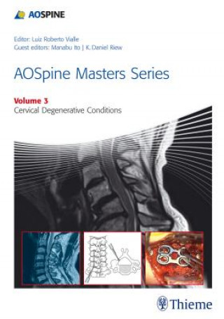 Carte AOSpine Masters Series Volume 3: Cervical Degenerative Conditions K. Riew