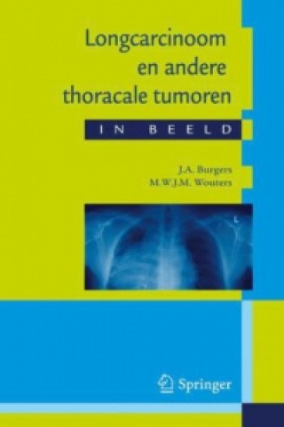 Carte Longcarcinoom En Andere Thoracale Tumoren in Beeld J A Burgers