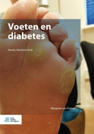 Libro Voeten en diabetes Margreet van Putten