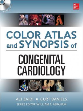 Carte Color Atlas and Synopsis of Adult Congenital Heart Disease Curt Daniels