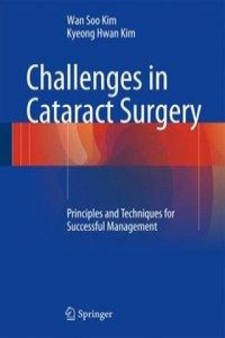 Könyv Challenges in Cataract Surgery Wan Soo Kim