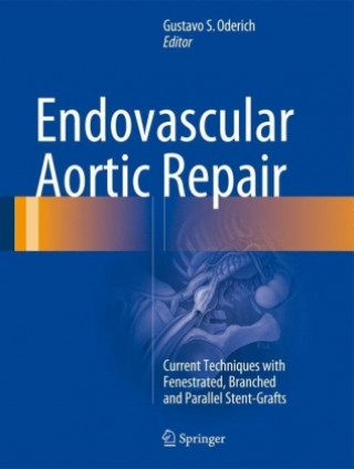 Kniha Endovascular Aortic Repair Gustavo S. Oderich
