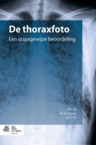 Книга De thoraxfoto M. J. Tip