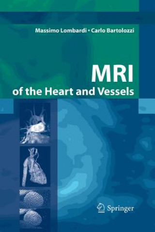Книга MRI of the Heart and Vessels Massimo Lombardi