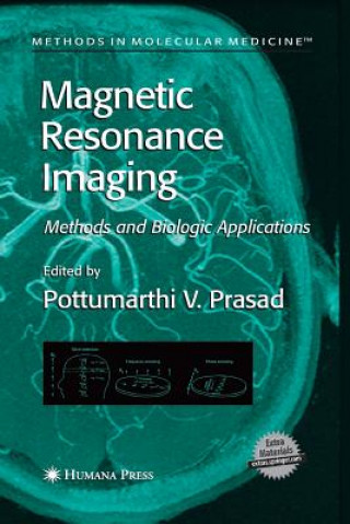 Könyv Magnetic Resonance Imaging Pottumarthi V. Prasad