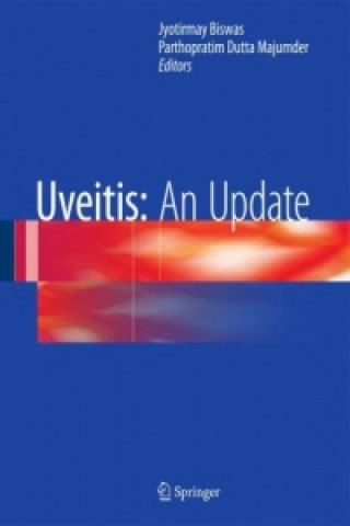 Книга Uveitis: An Update Jyotirmay Biswas