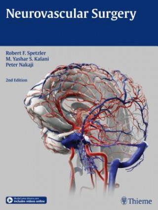 Kniha Neurovascular Surgery Robert F. Spetzler