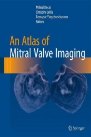 Kniha Atlas of Mitral Valve Imaging Milind Desai