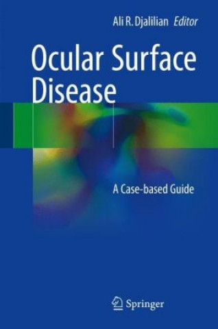 Kniha Ocular Surface Disease Ali R. Djalilian