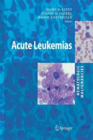 Carte Hematologic Malignancies: Acute Leukemias S. H. Faderl