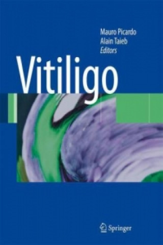 Kniha Vitiligo Mauro Picardo