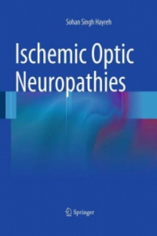 Książka Ischemic Optic Neuropathies Sohan Singh Hayreh