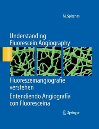 Kniha Understanding Fluorescein Angiography, Fluoreszeinangiografie verstehen, Entendiendo Angiografia con Fluoresceina Manfred Spitznas