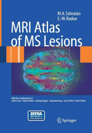 Book MRI Atlas of MS Lesions Ernst-Wilhelm Radu