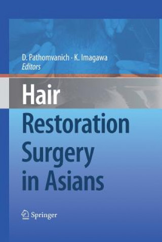 Könyv Hair Restoration Surgery in Asians Kenichiro Imagawa