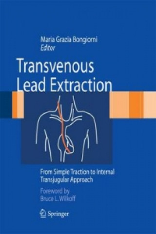 Knjiga Transvenous Lead Extraction Maria Grazia Bongiorni