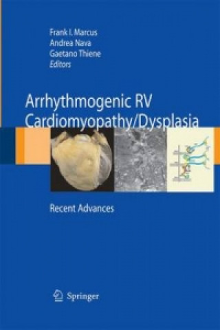 Book Arrhythmogenic RV Cardiomyopathy/Dysplasia Frank I. Marcus