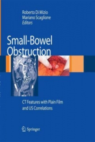 Könyv Small-Bowel Obstruction Roberto Di Mizio