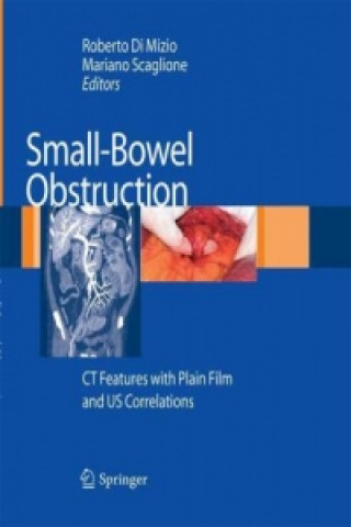 Książka Small-Bowel Obstruction Roberto Di Mizio