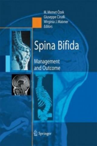 Könyv Spina Bifida Giuseppe Cinalli