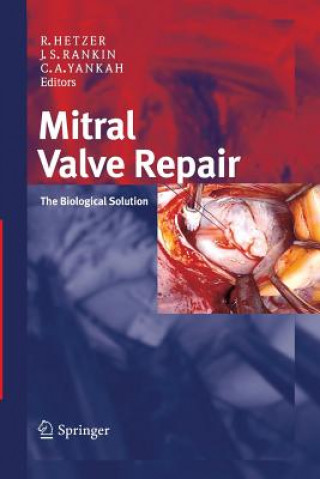 Книга Mitral Valve Repair Roland Hetzer