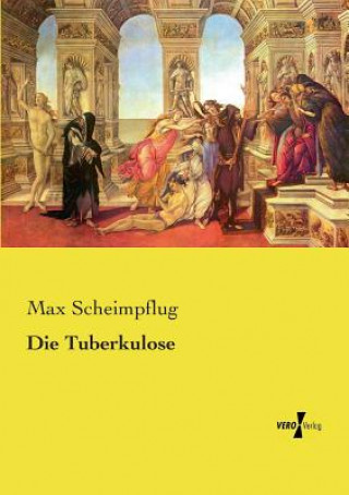 Knjiga Tuberkulose Max Scheimpflug