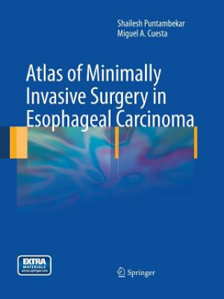 Könyv Atlas of Minimally Invasive Surgery in Esophageal Carcinoma Miguel Cuesta