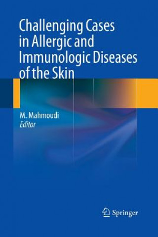 Książka Challenging Cases in Allergic and Immunologic Diseases of the Skin Massoud Mahmoudi