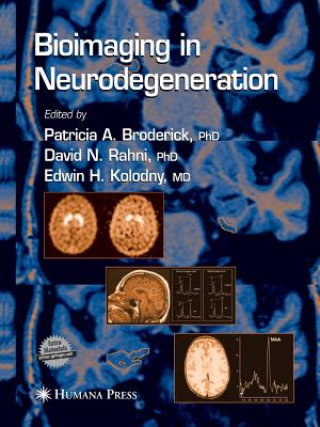 Buch Bioimaging in Neurodegeneration Patricia A. Broderick