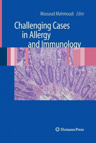 Książka Challenging Cases in Allergy and Immunology Massoud Mahmoudi