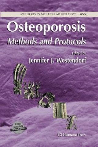 Book Osteoporosis Jennifer Westendorf