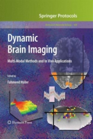 Carte Dynamic Brain Imaging Fahmeed Hyder