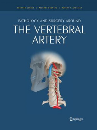 Könyv Pathology and surgery around the vertebral artery Michaël Bruneau