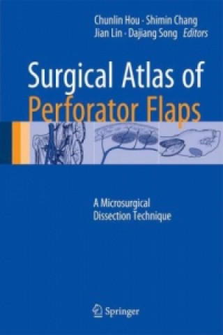 Книга Surgical Atlas of Perforator Flaps Chunlin Hou