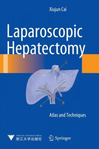 Libro Laparoscopic Hepatectomy Xiujun Cai