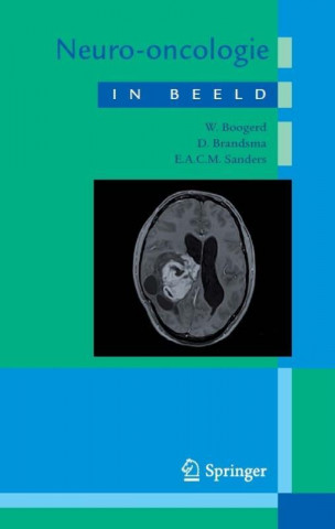 Książka Neuro-oncologie in beeld W. Boogerd