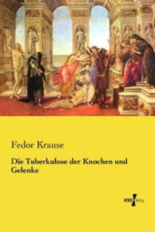 Knjiga Die Tuberkulose der Knochen und Gelenke Fedor Krause