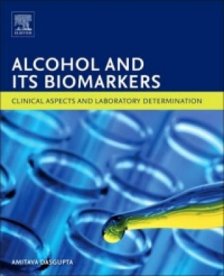 Carte Alcohol and Its Biomarkers Amitava Dasgupta