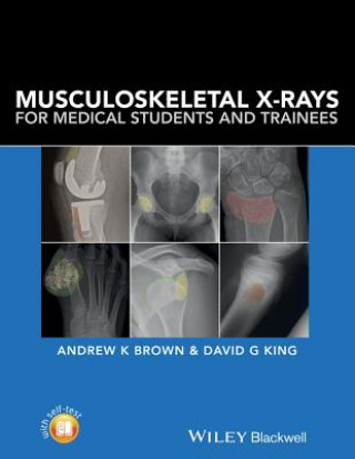 Kniha Musculoskeletal X-rays for Medical Students Andrew K Brown