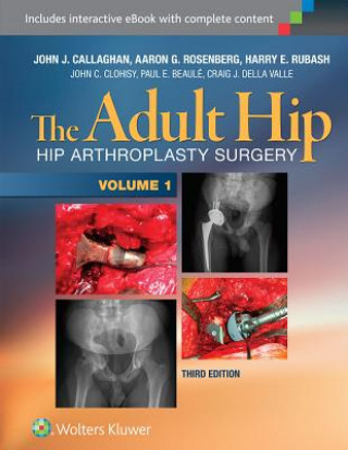 Kniha Adult Hip (Two Volume Set) John J Callaghan