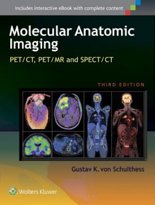 Könyv Molecular Anatomic Imaging Gustav K Von Schulthess