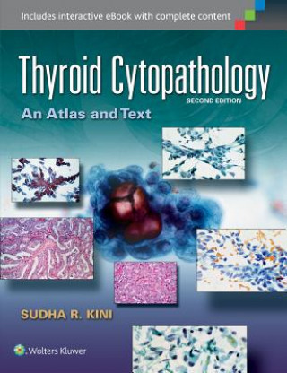 Kniha Thyroid Cytopathology Sudha R Kini