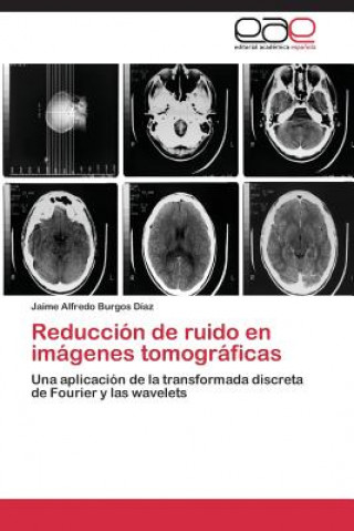 Könyv Reduccion de ruido en imagenes tomograficas Burgos Diaz Jaime Alfredo