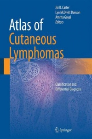 Kniha Atlas of Cutaneous Lymphomas Joi B. Carter