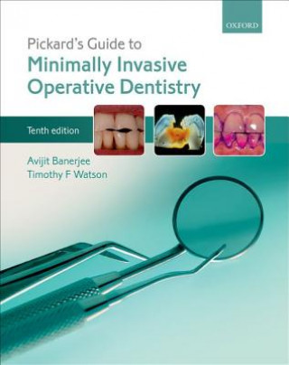 Książka Pickard's Guide to Minimally Invasive Operative Dentistry Avit Banerjee