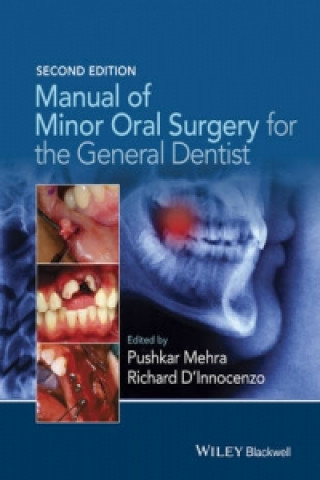 Könyv Manual of Minor Oral Surgery for the General Dentist 2e Pushkar Mehra