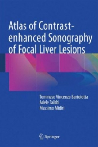 Könyv Atlas of Contrast-enhanced Sonography of Focal Liver Lesions Tommaso Vincenzo Bartolotta