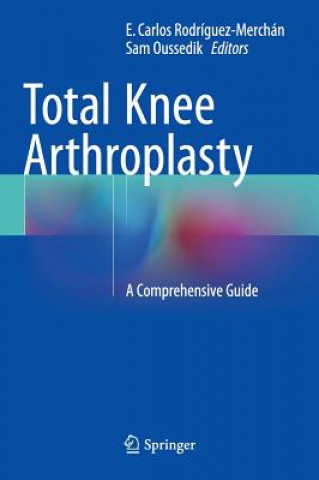 Könyv Total Knee Arthroplasty Sam Oussedik